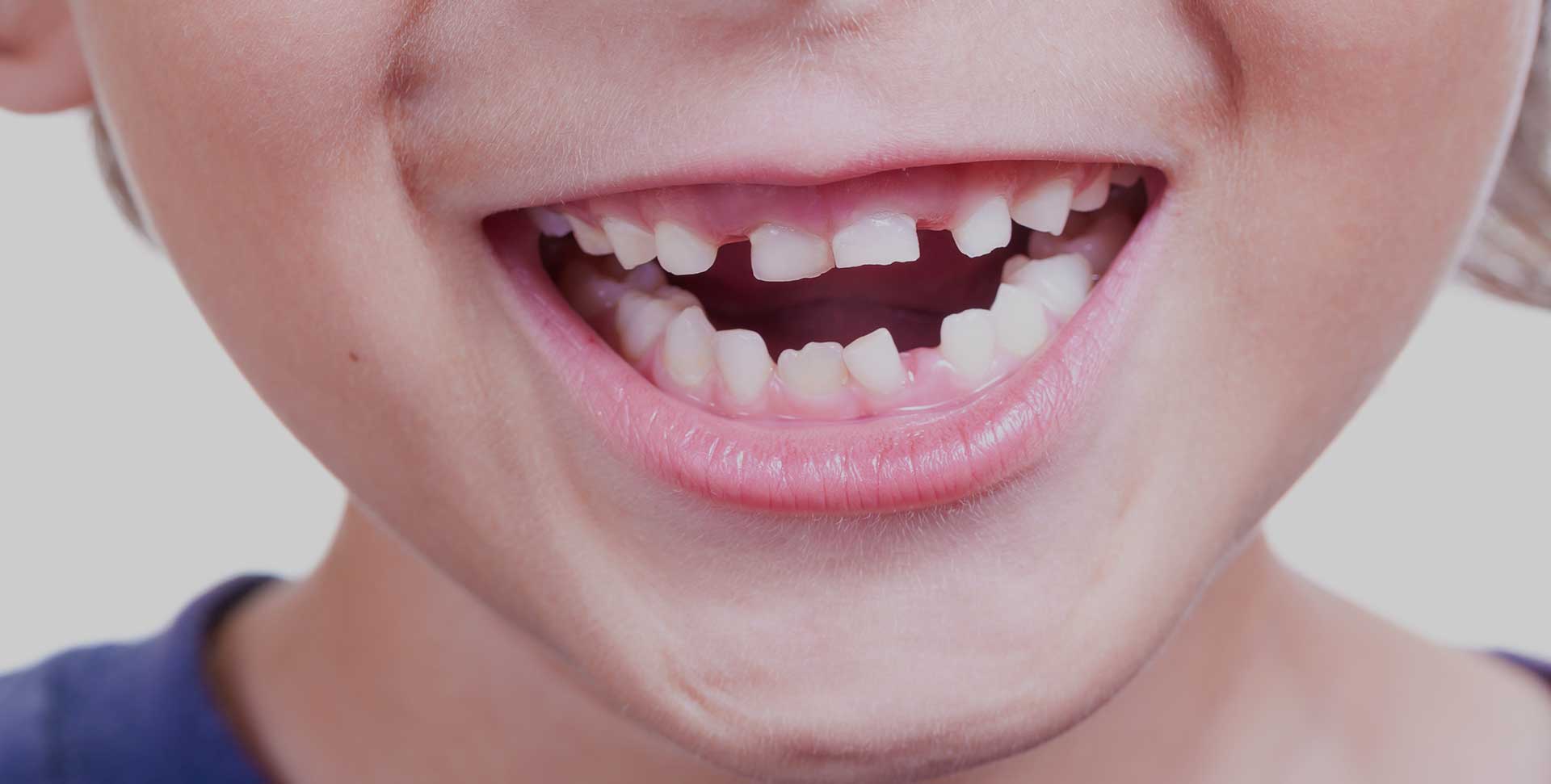 Walden Orthodontics | SE Calgary Orthodontist | Early Orthodontic Treatment Banner