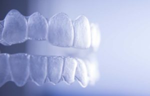Walden Orthodontics | SE Calgary Orthodontist | Invisalign Invisible Braces