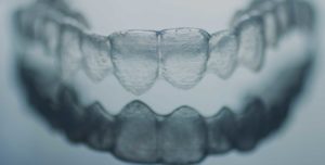 Walden Orthodontics | SE Calgary Orthodontist | Invisalign Invisible Braces