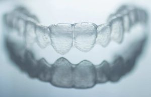 Walden Orthodontics | SE Calgary Orthodontist | Invisalign Invisible Braces