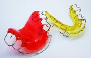Walden Orthodontics | SE Calgary Orthodontist | Orthodontic Retainers