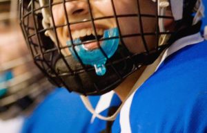 Walden Orthodontics | SE Calgary Orthodontist | Sports Mouth Guards
